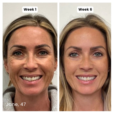 Prequel Anti-Aging Silicone Scar Stick