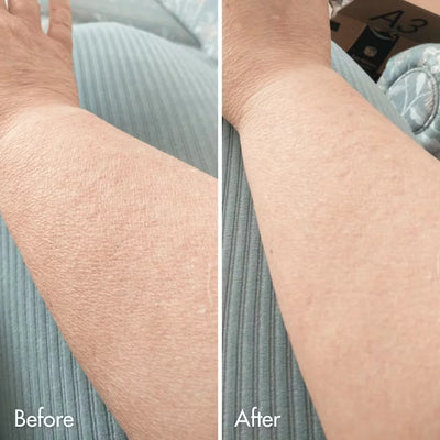 Retinol Renewal Body Lotion – Firming, Smoothing & Anti-Aging Hydration